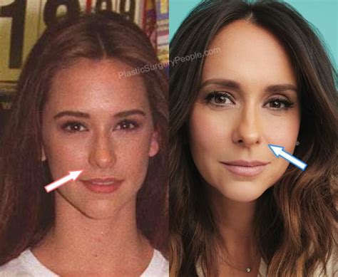 has jennifer love hewitt had plastic surgery|Jennifer Love Hewitt Addresses Plastic Surgery Speculation 